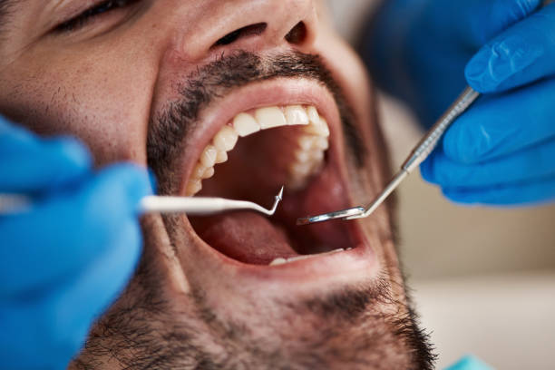Best Emergency Broken Tooth Repair in Beloit, WI